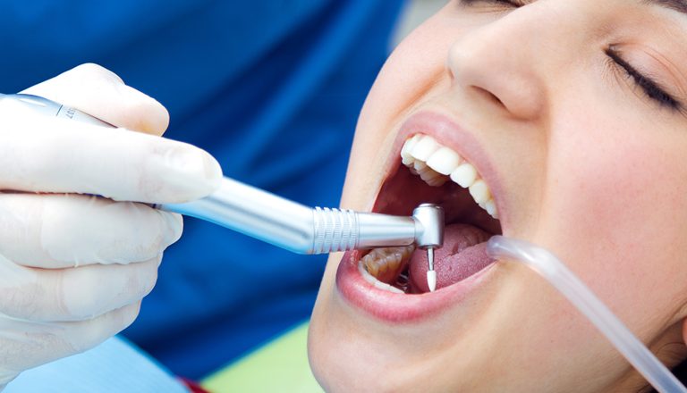 deep-cleaning-teeth-